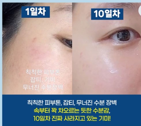 HUE CALM vegan serum to fade dark spots, freckles, and whiten skin HUE CALM vegan serum to fade dark spots, freckles, and whiten skin